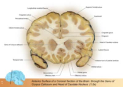 Brain Coronal Plane